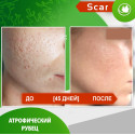 Карипаин Скар от рубцов и шрамов  (40 г)