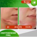 Карипаин Скар от рубцов и шрамов  (40 г)