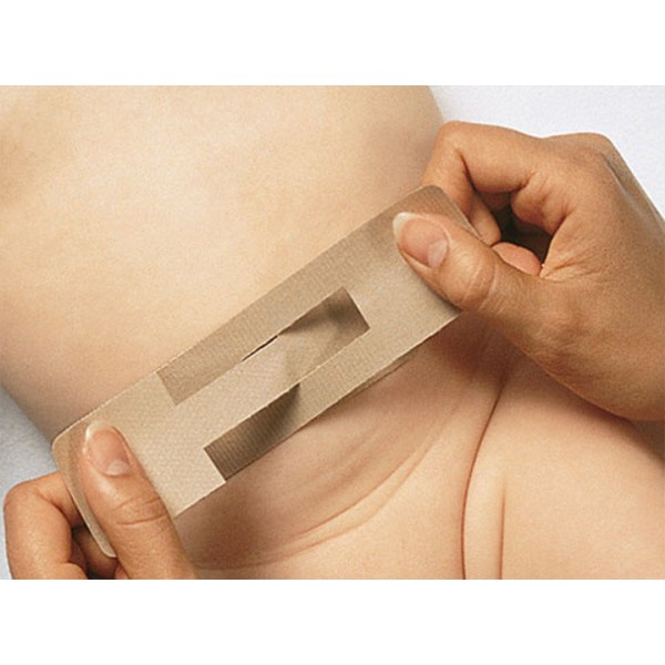 Пупочные корректоры